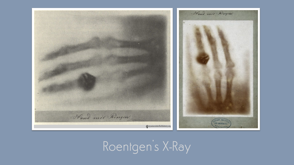 The Kick-About #103 ‘Roentgen’s X-Ray’
